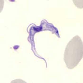 Image: Trypanosoma brucei  ssp. in human blood (Photo courtesy of US Centers for Disease Control and Prevention).